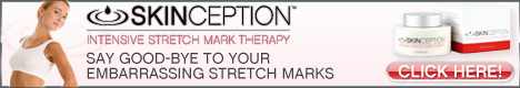 Order Stretch Mark