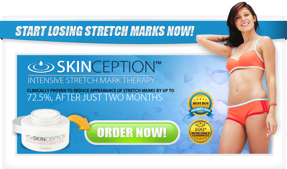 buy stretchmark cream