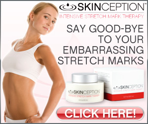  Get Stretch Mark Now